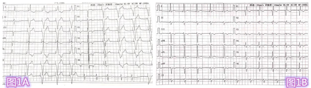 图片1.png 图片1.png