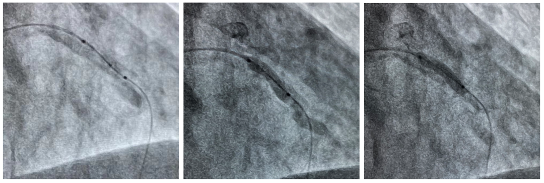 图片3.png 图片3.png