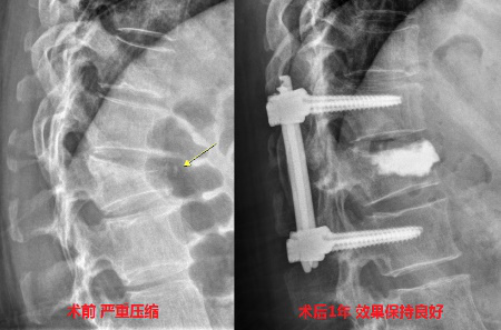 图片5.png 图片5.png