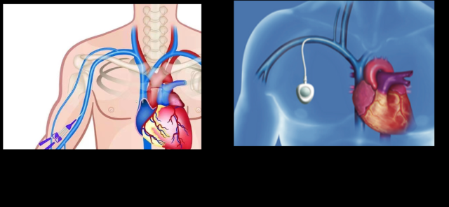 图片11.png 图片11.png