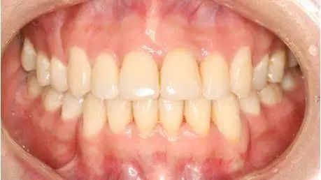 图片8.png 图片8.png