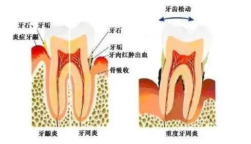 图片12.png 图片12.png