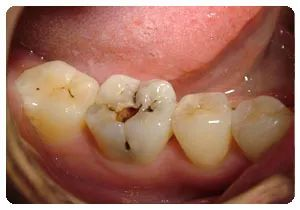 图片14.png 图片14.png