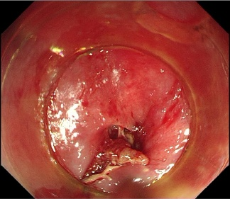 图片3.png 图片3.png