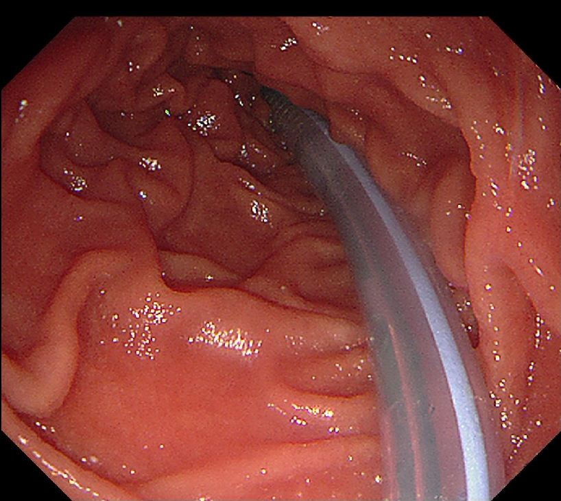 图片4.png 图片4.png