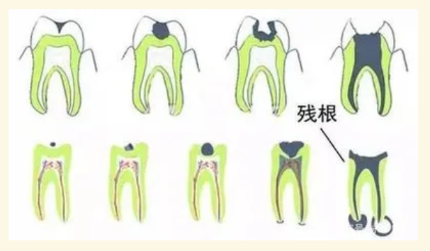 图片.png 图片.png