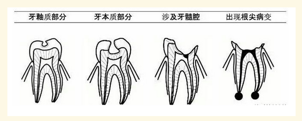 图片.png 图片.png