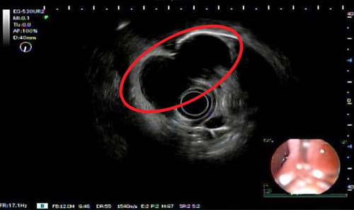 00 B超内镜检查.jpg 00 B超内镜检查.jpg