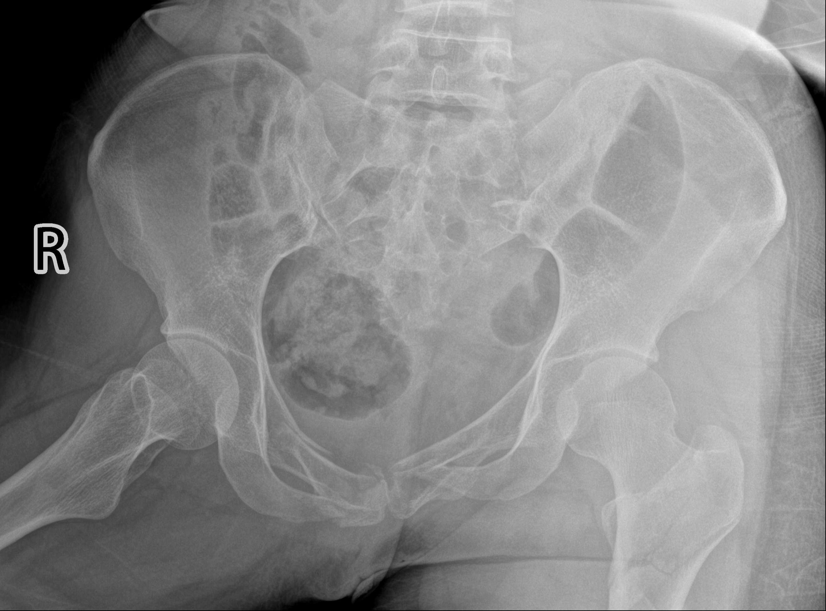 2术前.bmp 2术前.bmp