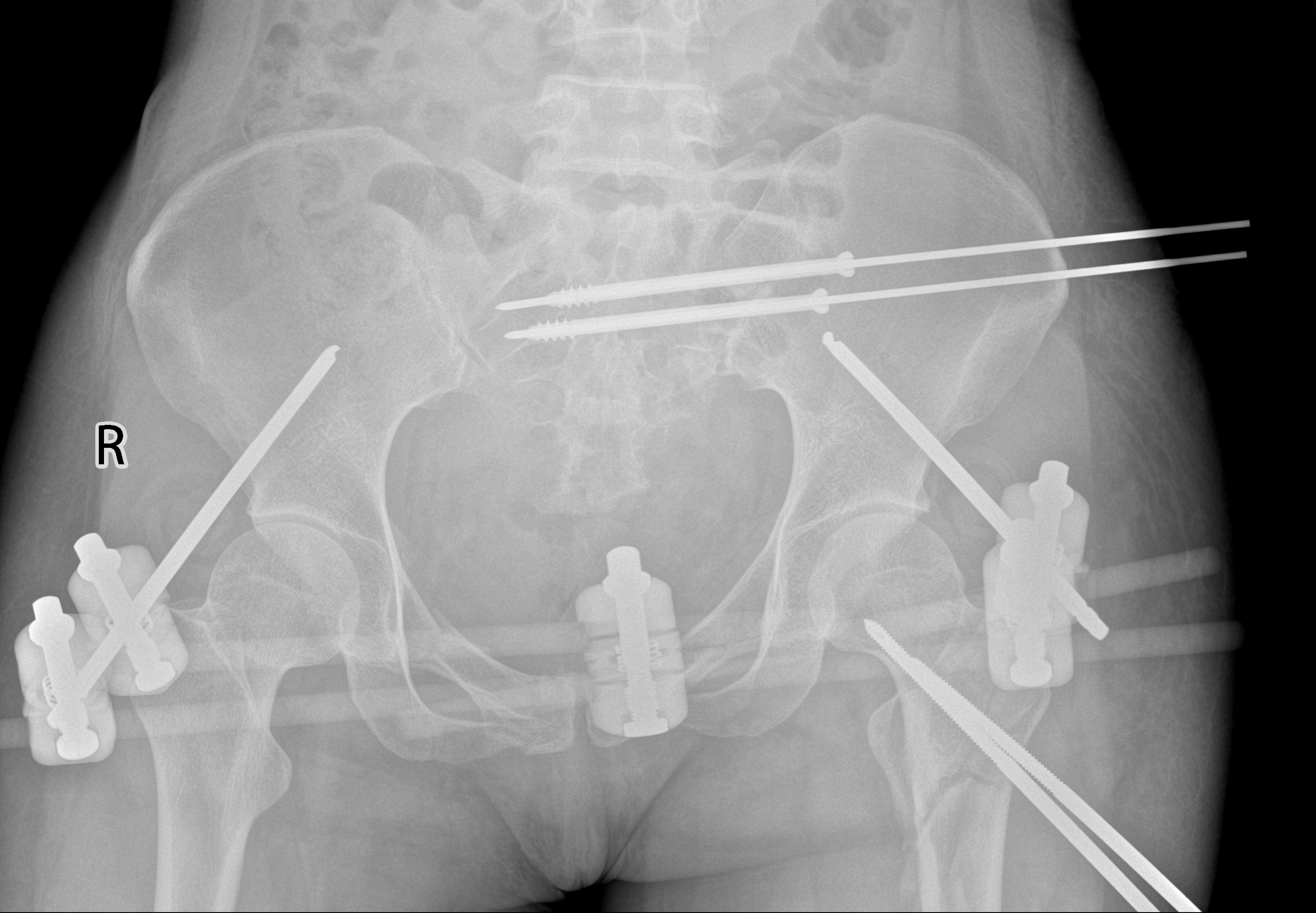 2术后.bmp 2术后.bmp