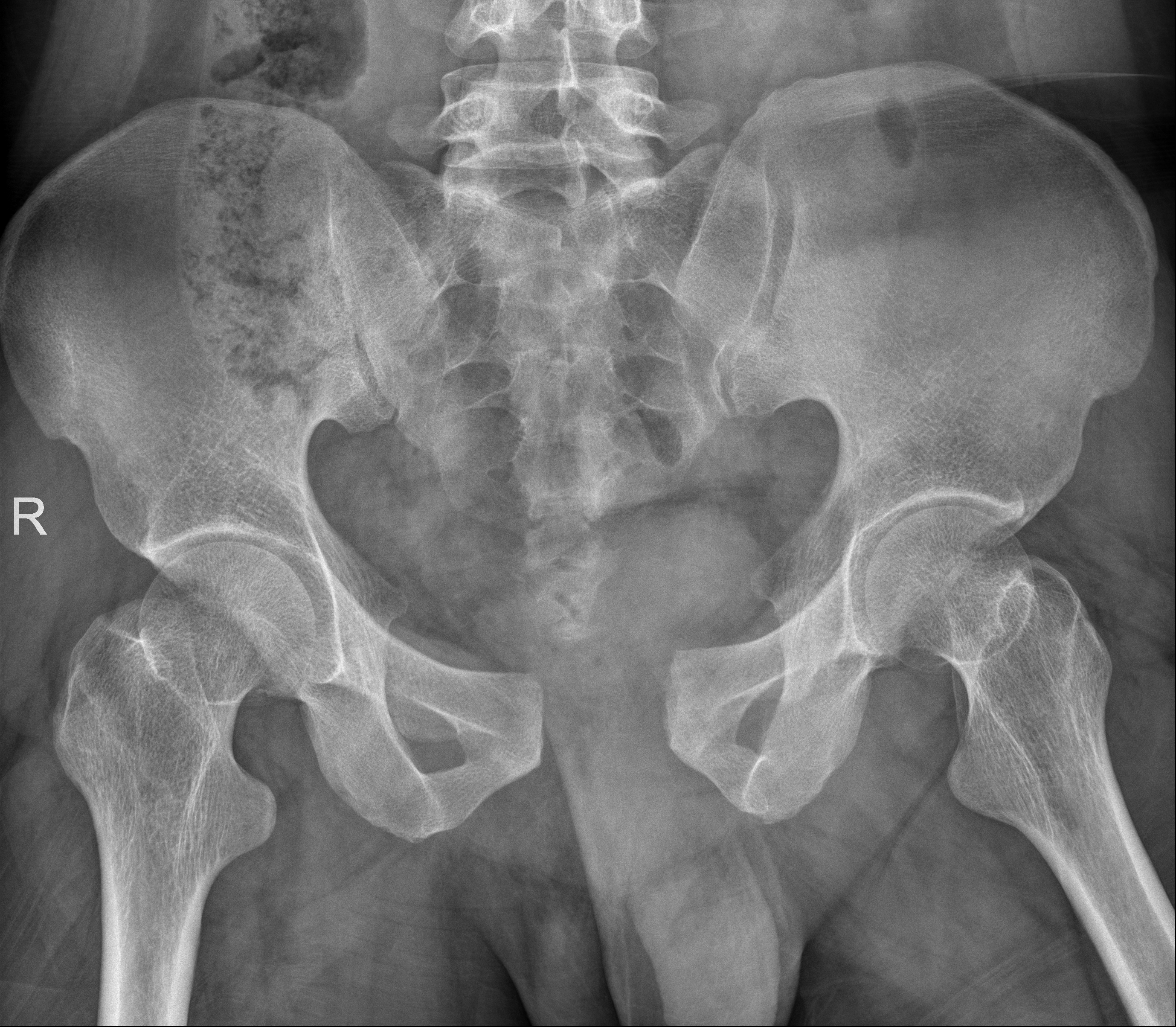 3.术前.bmp 3.术前.bmp