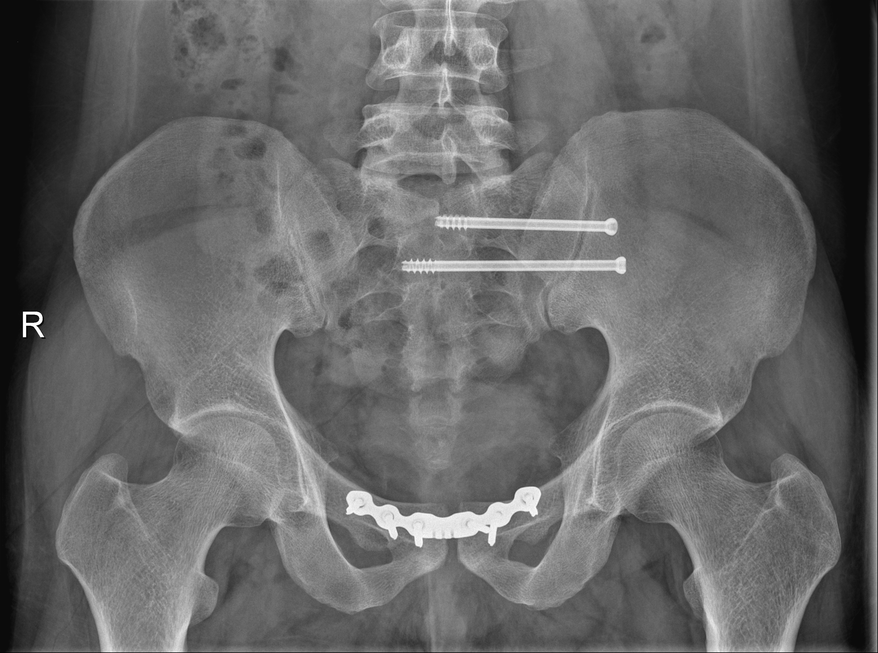 3.术后.bmp 3.术后.bmp