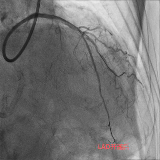 LAD开通后.jpg LAD开通后.jpg