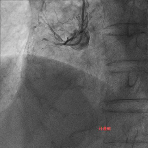 RCA开通前.jpg RCA开通前.jpg