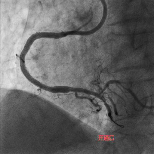 RCA开通后.jpg RCA开通后.jpg