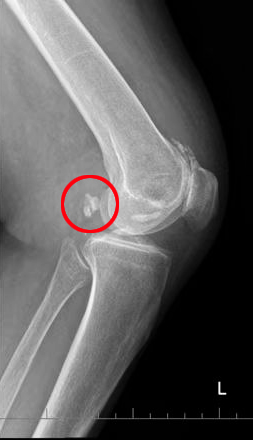 术前.jpg 术前.jpg