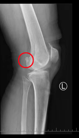 术后.jpg 术后.jpg