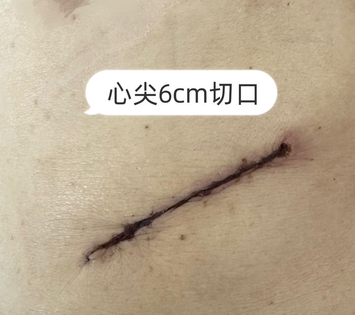 0 术后.jpg 0 术后.jpg