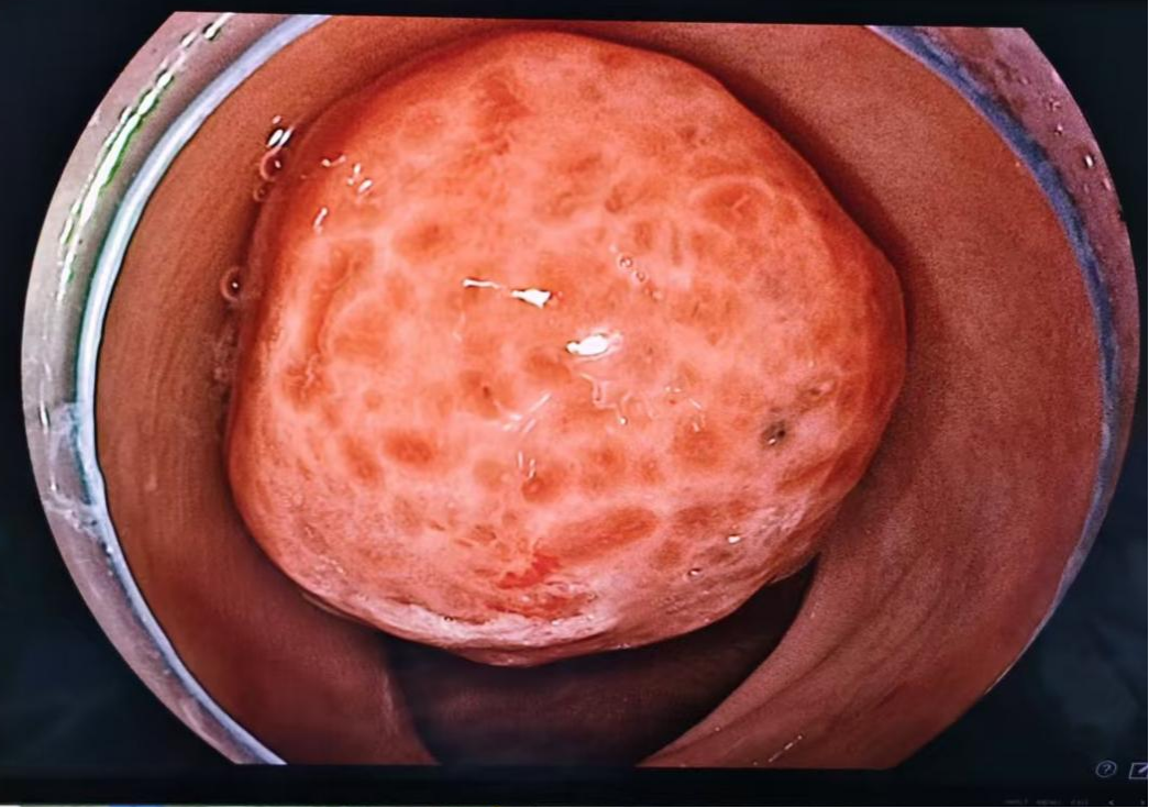 图片5.png 图片5.png