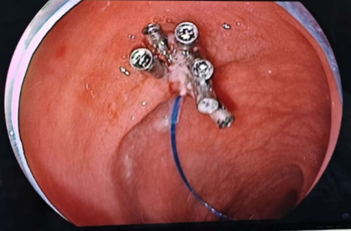 图片7.png 图片7.png