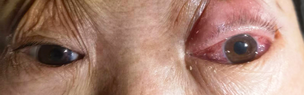 术前0.jpg 术前0.jpg