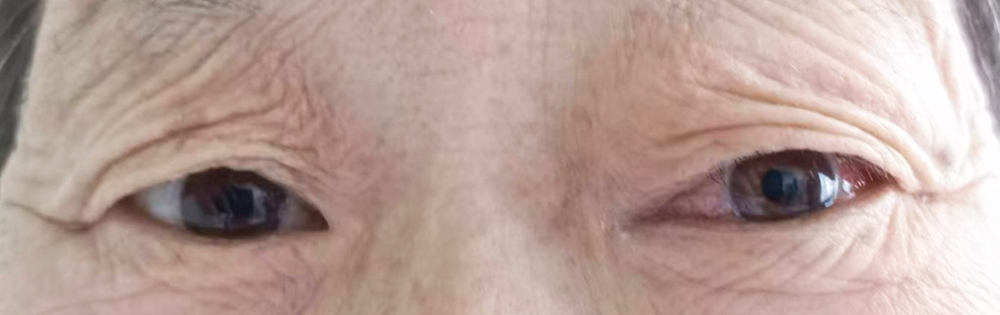 术后0.jpg 术后0.jpg