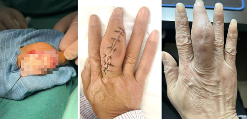 图片3.png 图片3.png